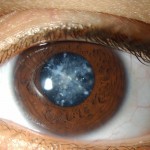 cataracta-pelicula-de-pe-ochi