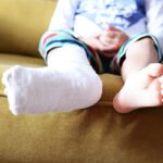 little-child-with-plaster-bandage-on-leg-heel-fractured
