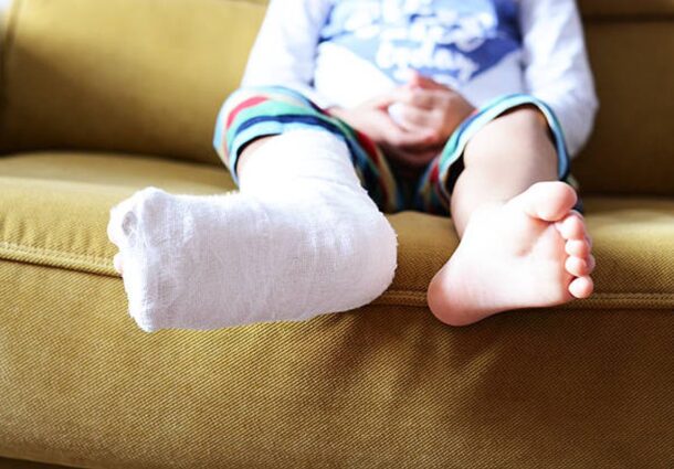 little-child-with-plaster-bandage-on-leg-heel-fractured