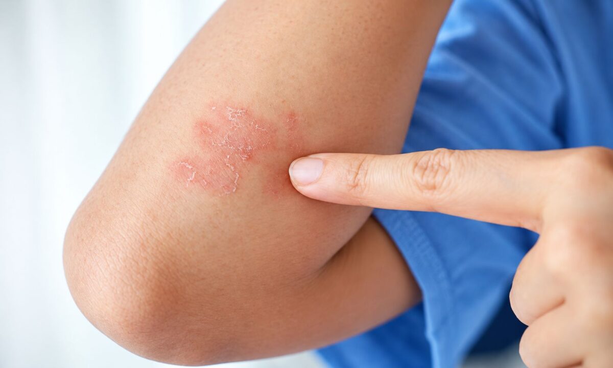 Petele de pe piele care ar trebui să îți atragă atenția Când pot semnala o afecțiune