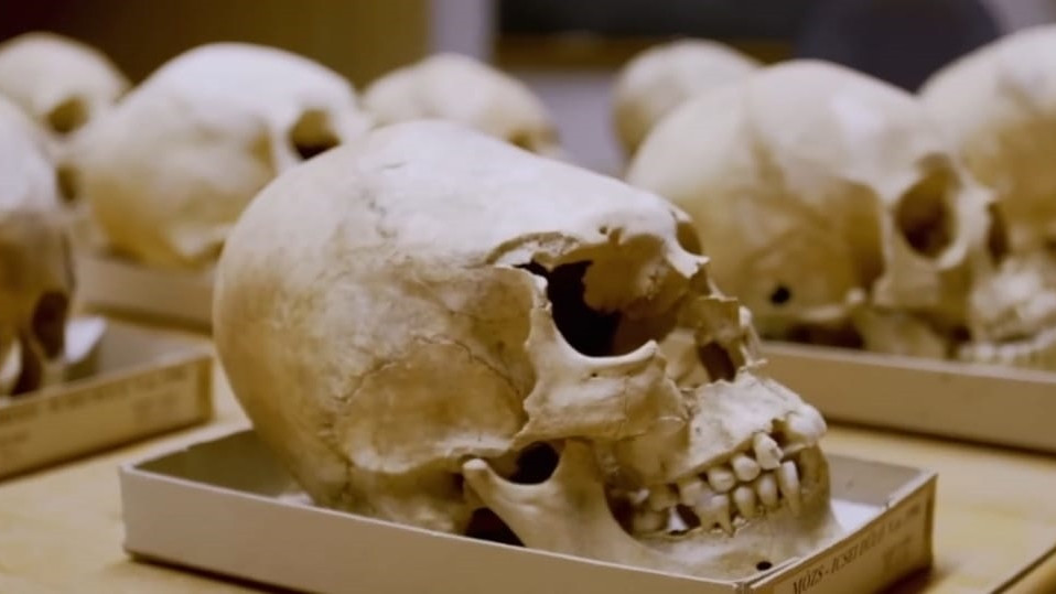 Oamenii din Antichitate au creat o cupa misterioasa din craniul unei persoane moarte