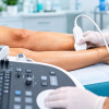 Ecografia Doppler poate arăta ce se întâmplă cu circulația înainte ca simptomele să se agraveze